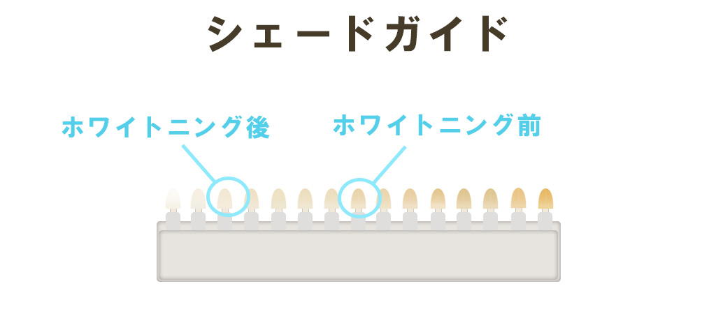 ホワイトニングシェードガイド