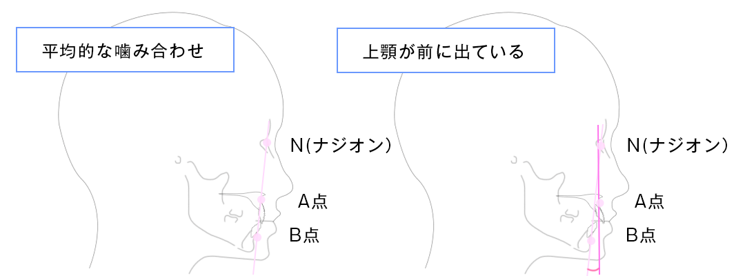 セファロ機能・矯正歯科｜立石たけしま歯科