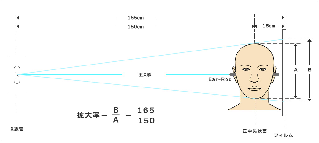 セファロ機能｜立石たけしま歯科・青砥駅